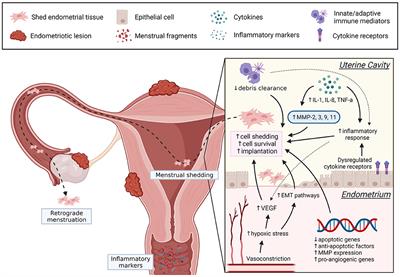 Menstruation Dysregulation and Endometriosis Development